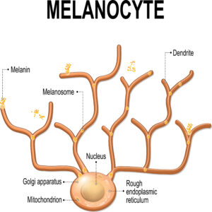 melanoma, melanocytes, eye disease, optometry